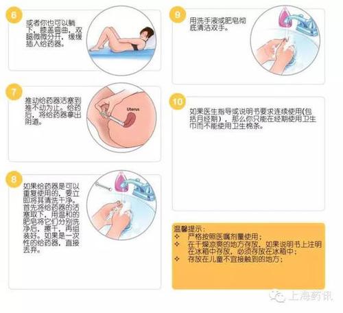 阴道给药