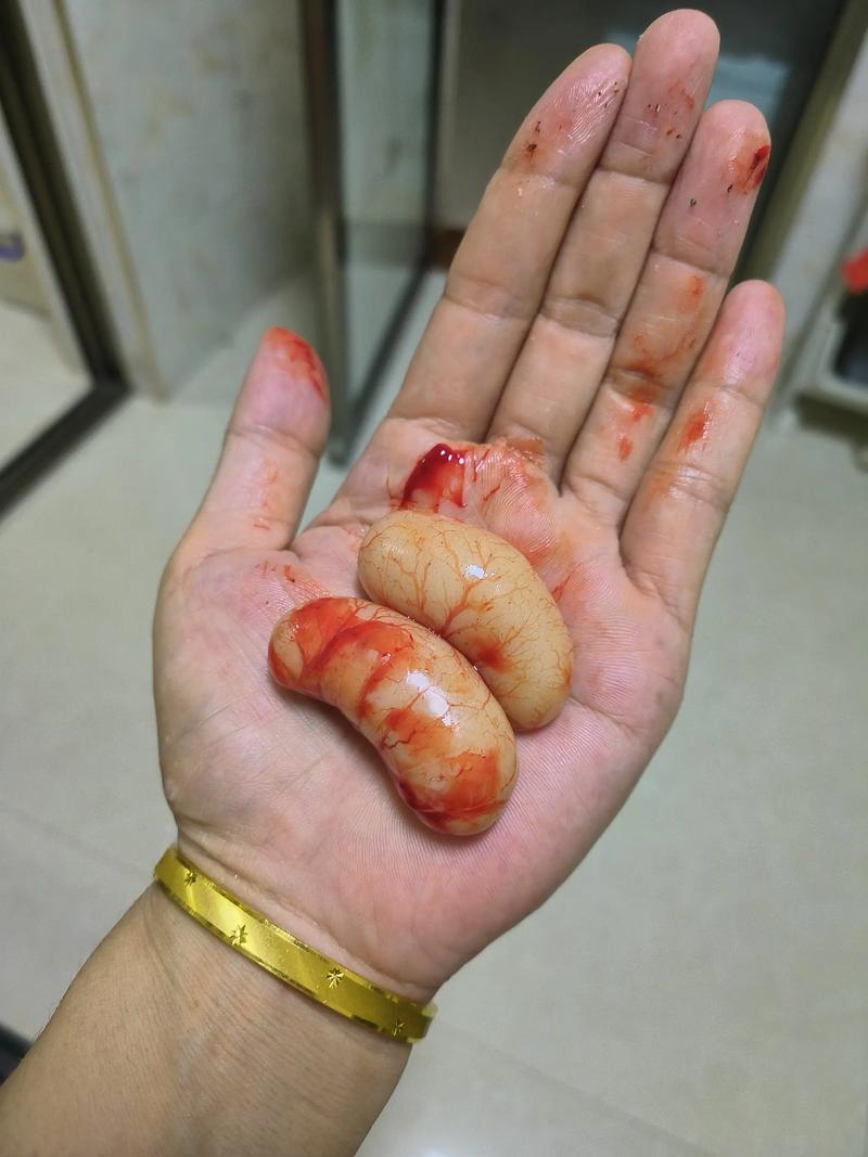 两个卵