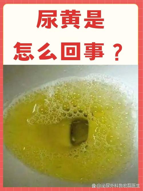 尿液偏黄