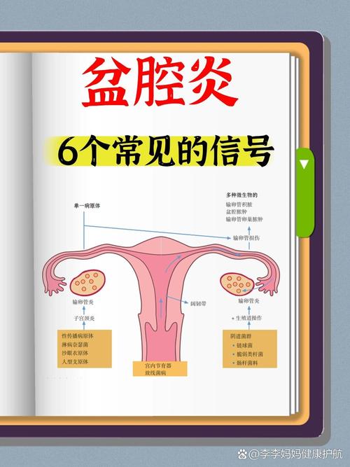 盆腔原因