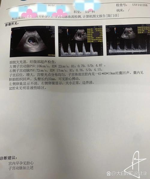 移植后53天