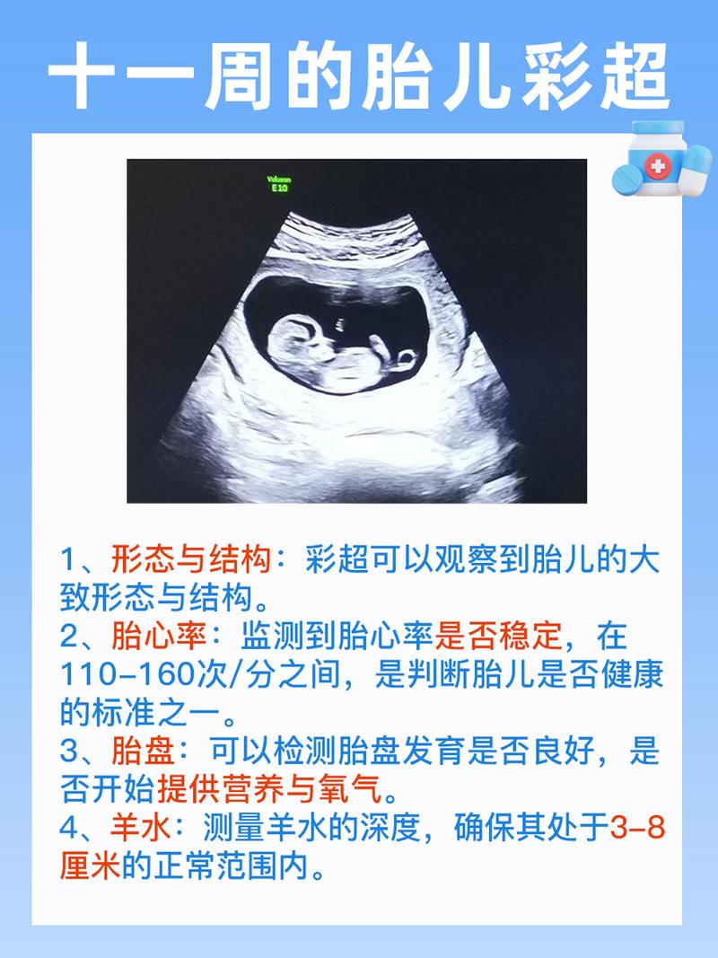移植十一周