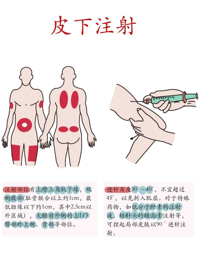 皮下注射