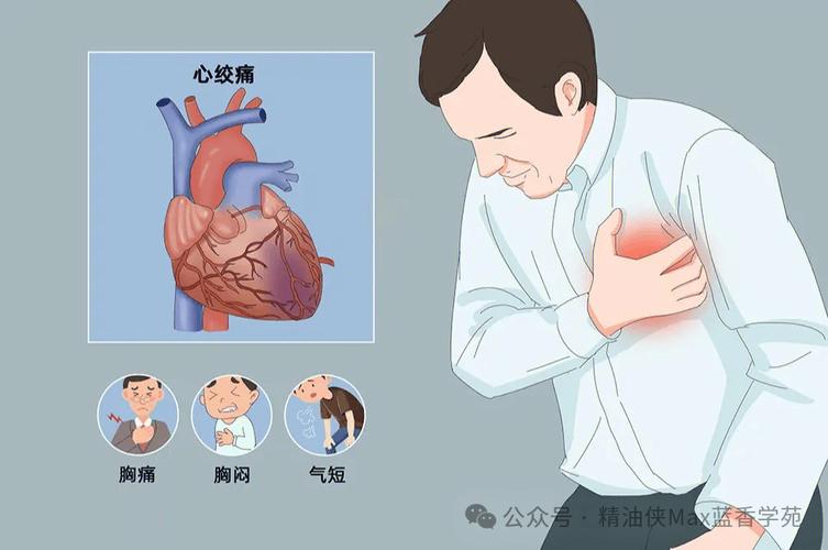 心血管负担