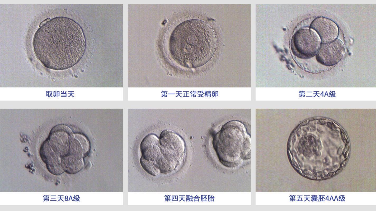 植入两个胚胎