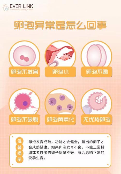  卵子异常受精