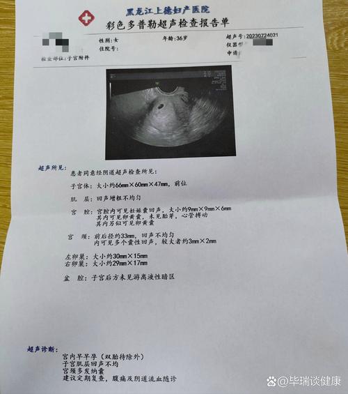 移植后十六周