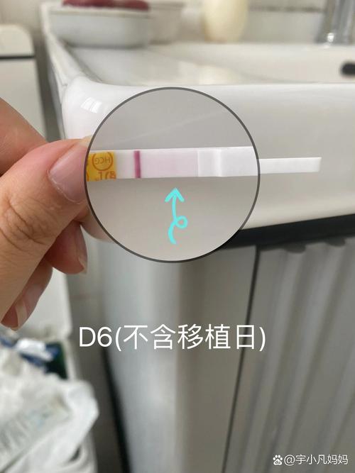 第三天移植