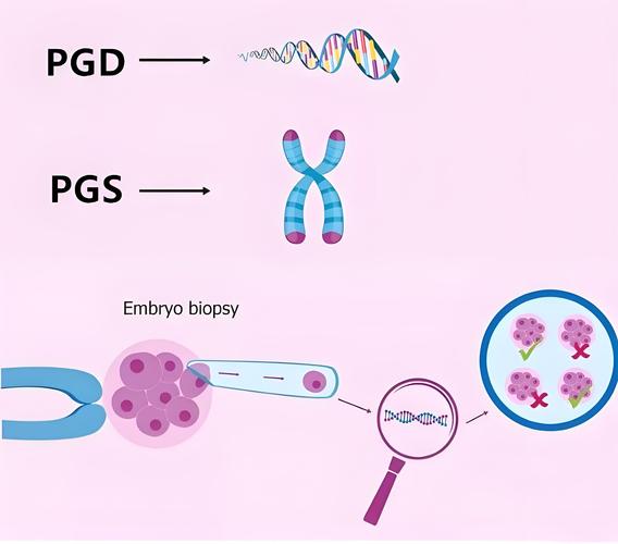 PGS/PGD检测