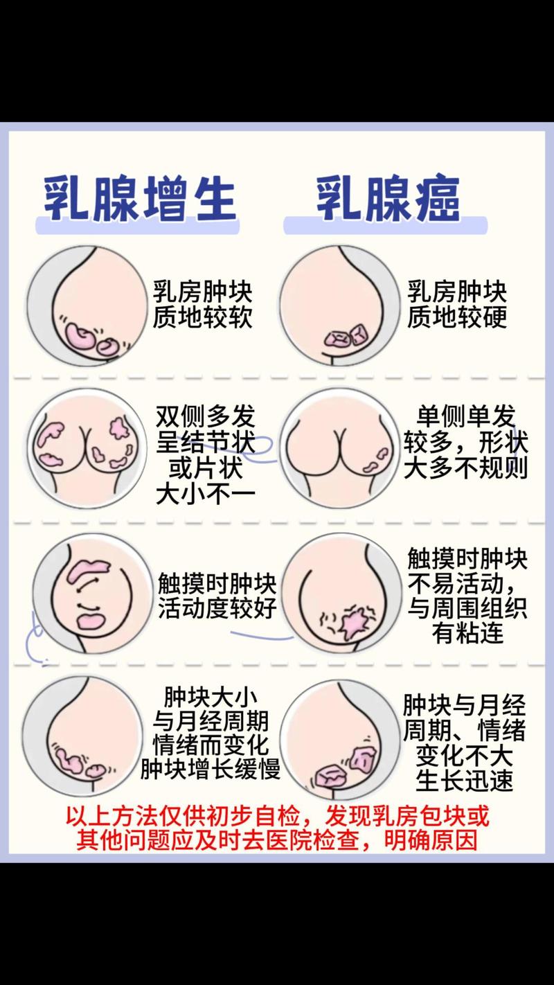  乳腺增生