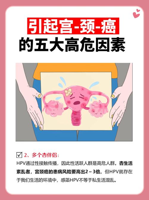 宫颈癌风险

好的