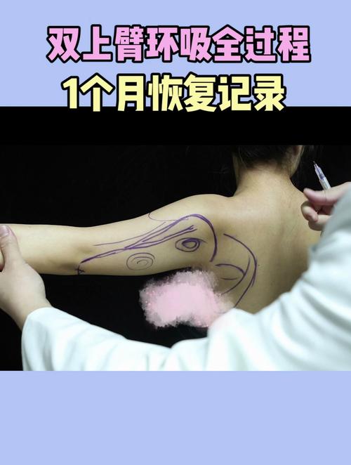  恢复过程