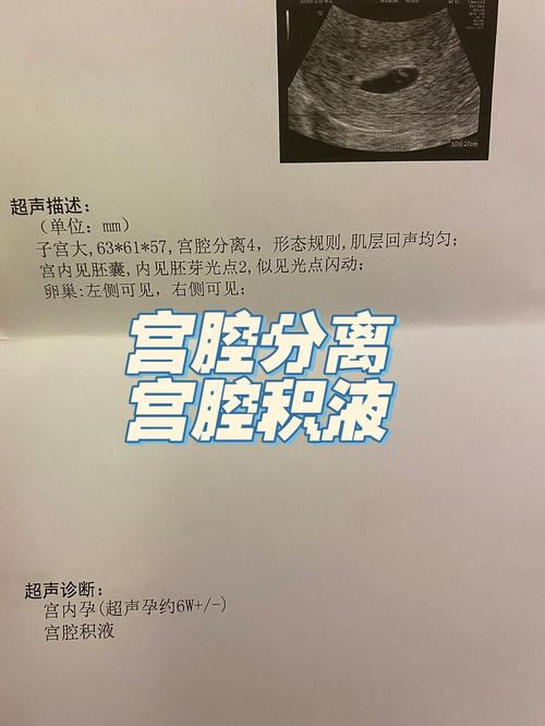 胚胎误换