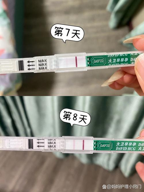 移植8周