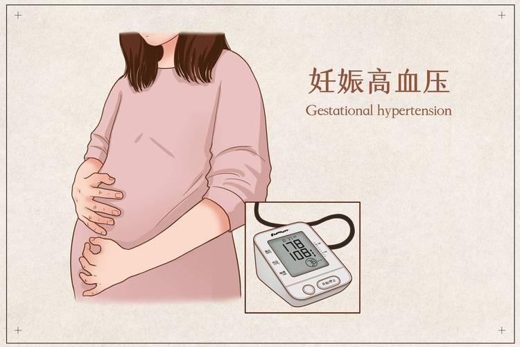 妊娠高血压