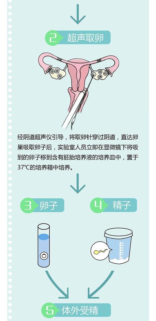 胚胎移植
描述: 本文借助动画图详细解读了一代试管婴儿的历程，包括促排卵、取卵取精、体外受精、胚胎移植等环节，还列举数据和案例说明其对解决生育难题的重要性，让读者了解这一神奇技术。