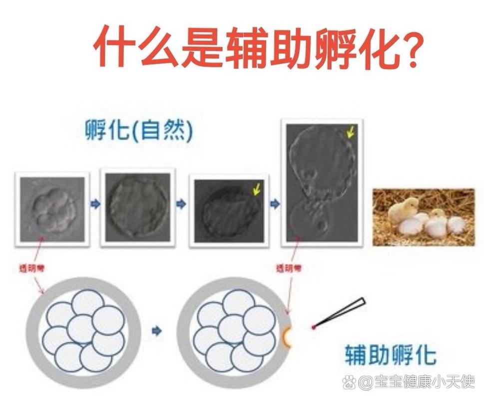 辅助孵化技术