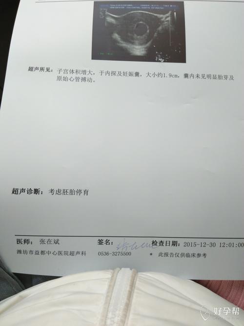11周未发现胎心