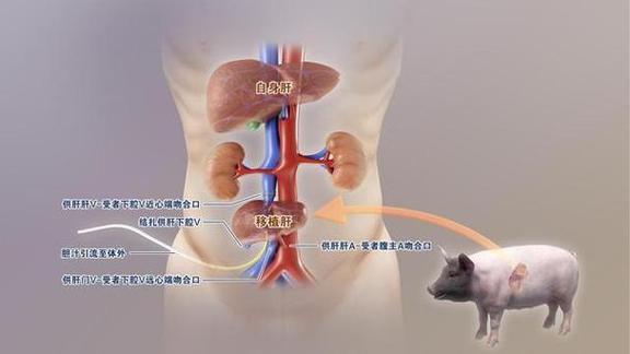 试管移植过程中是否可以使用猪内脏作为材料？