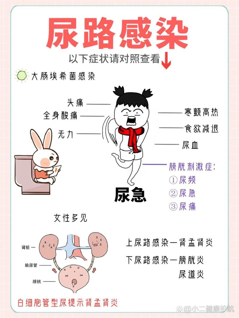  尿路感染