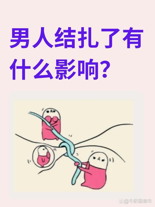 男性节育
