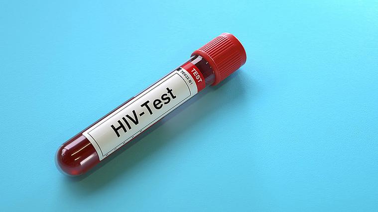 HIV试管