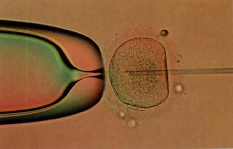  In Vitro Fertilization