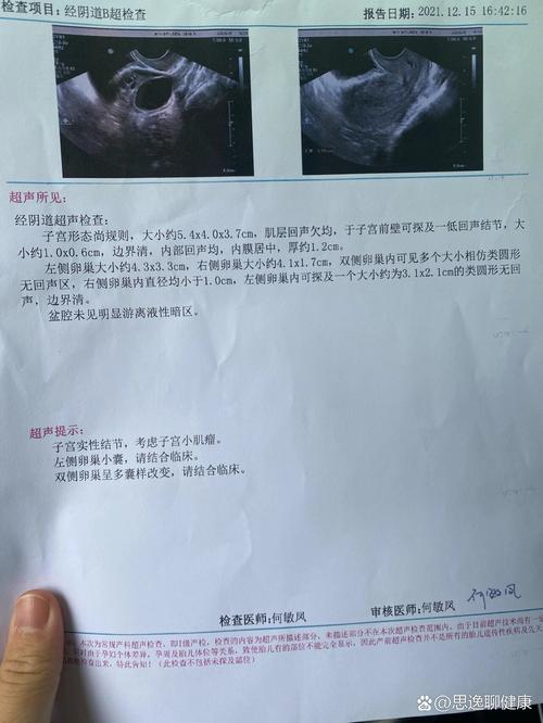 卵泡提前破裂