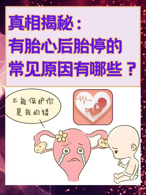 有胎心后胎停