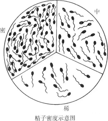 精子密度