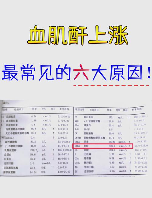 肌酐升高