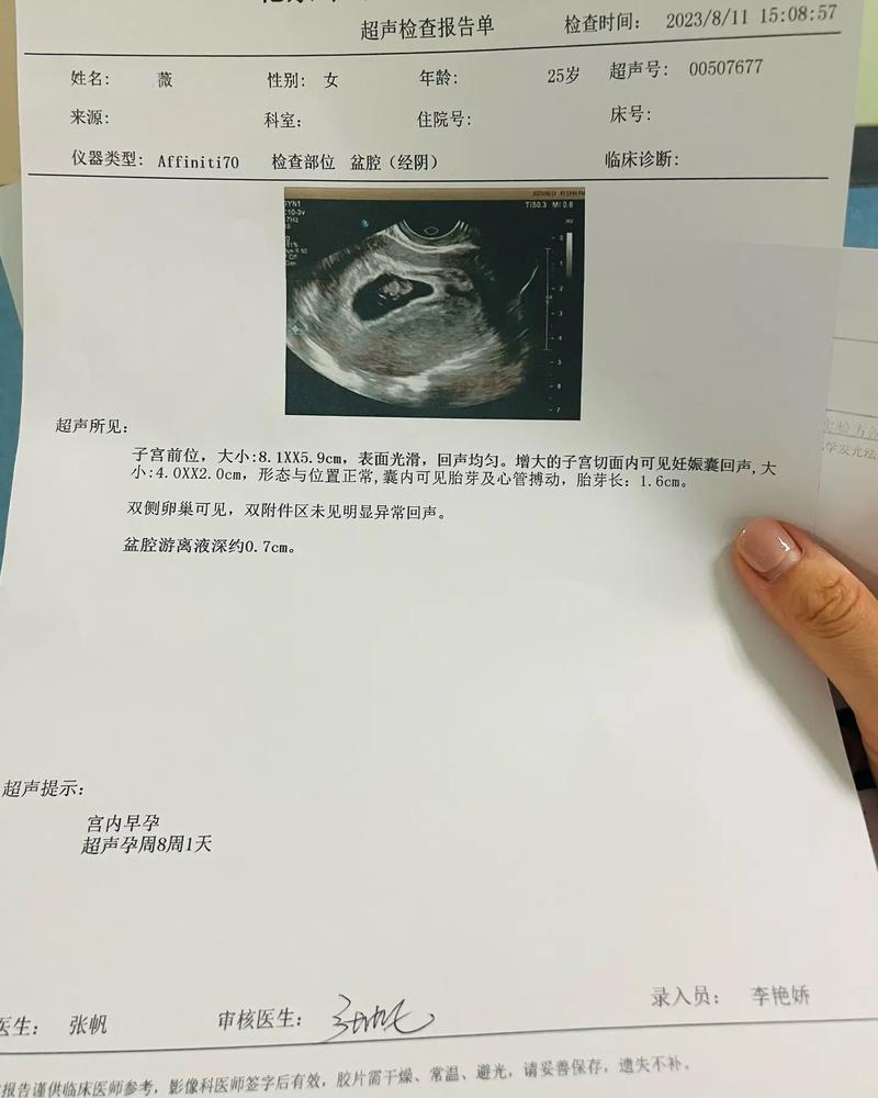 怀孕结果