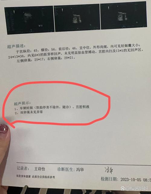 未见胎心搏动
