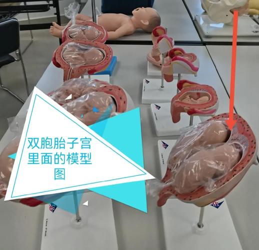 双胚胎放置