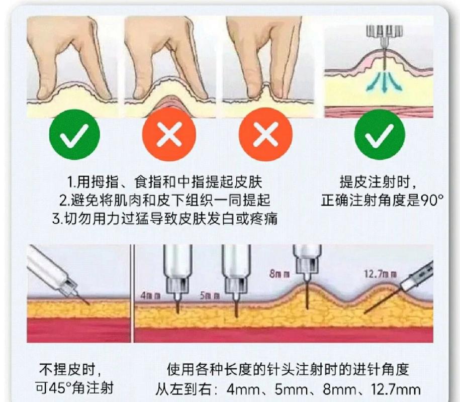 肝素注射