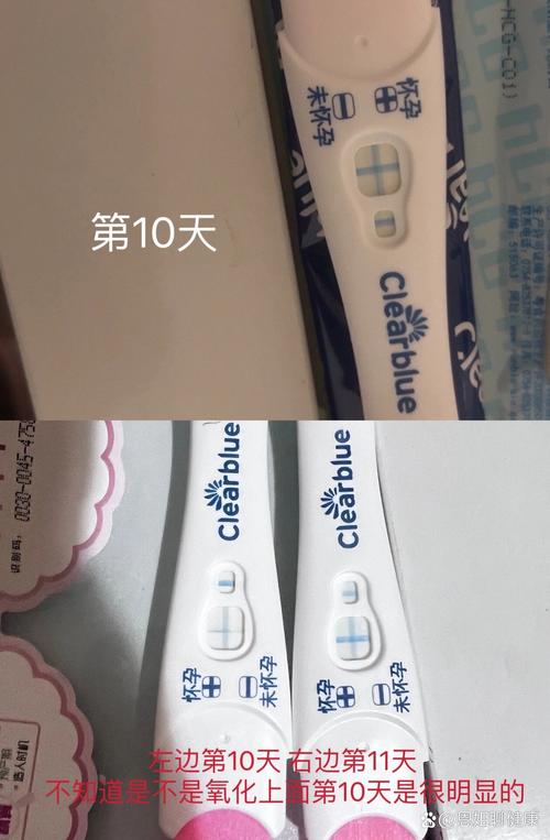 第三天冻胚移植