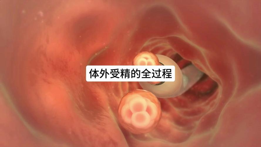 受精技术