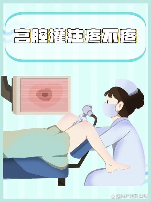 子宫灌注