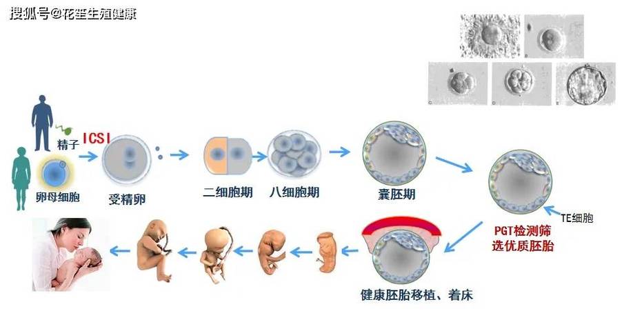  试管3细胞技术