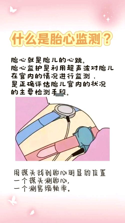 胎心推迟