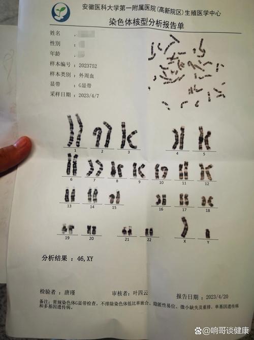 胚胎染色体缺失