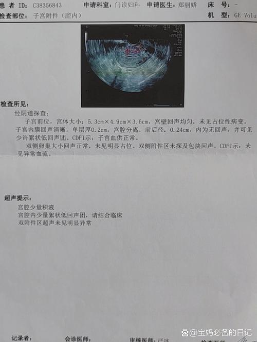 第24天结果
