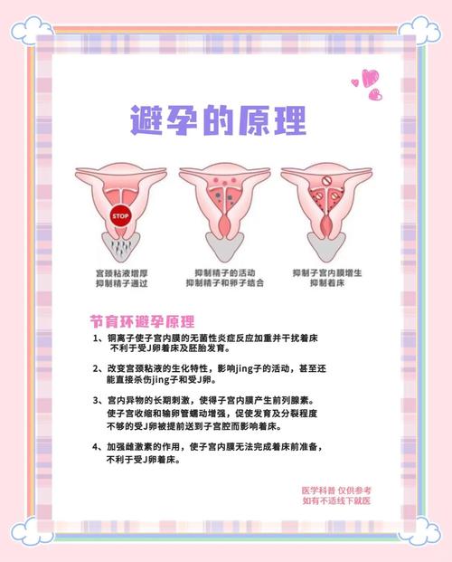 女性节育