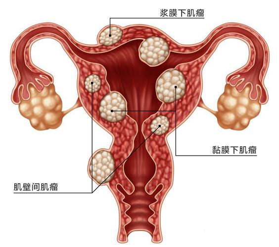 子宫附件