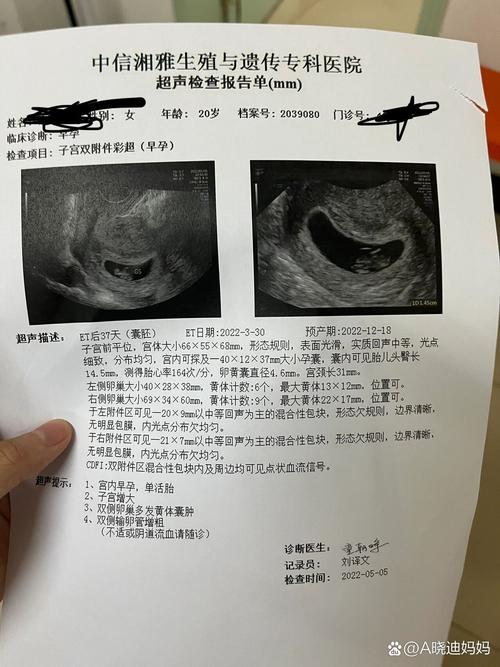 移植37天