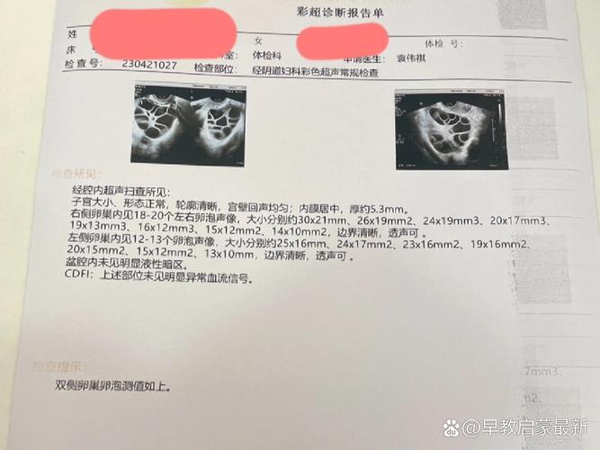 卵泡促不起来