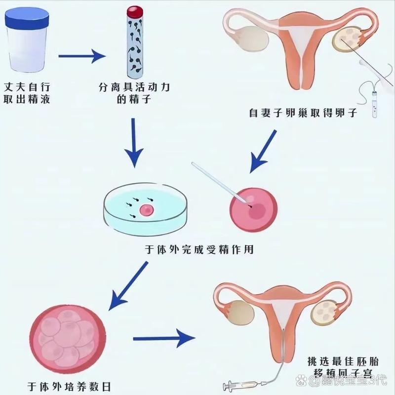 子宫内膜损伤患者是否可以考虑试管婴儿？