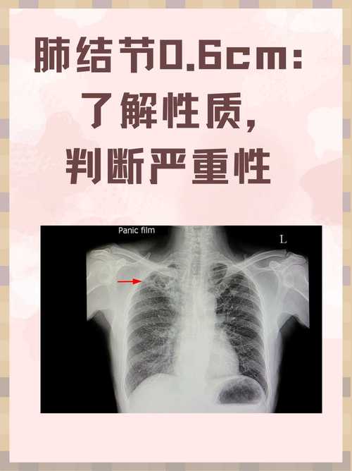 严重性