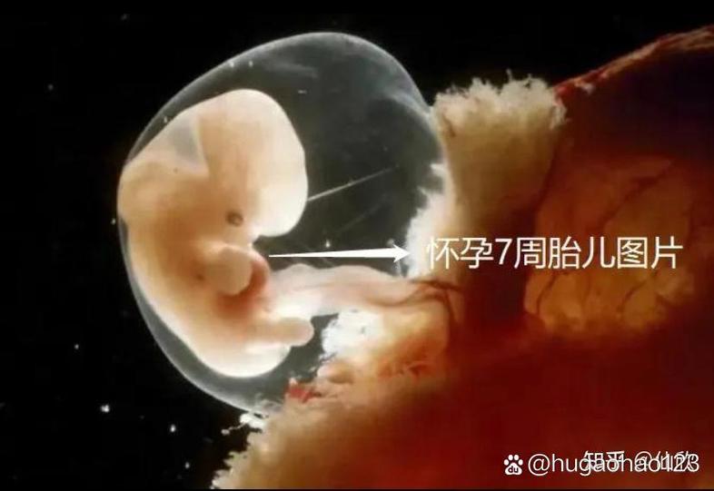 7C胚胎