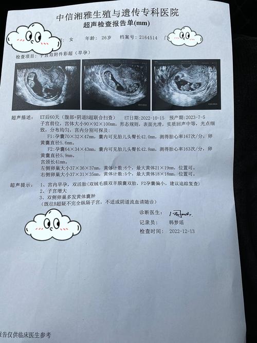 移植60天